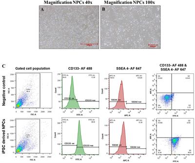 A protein–miRNA biomic analysis approach to explore neuroprotective potential of nobiletin in human neural progenitor cells (hNPCs)